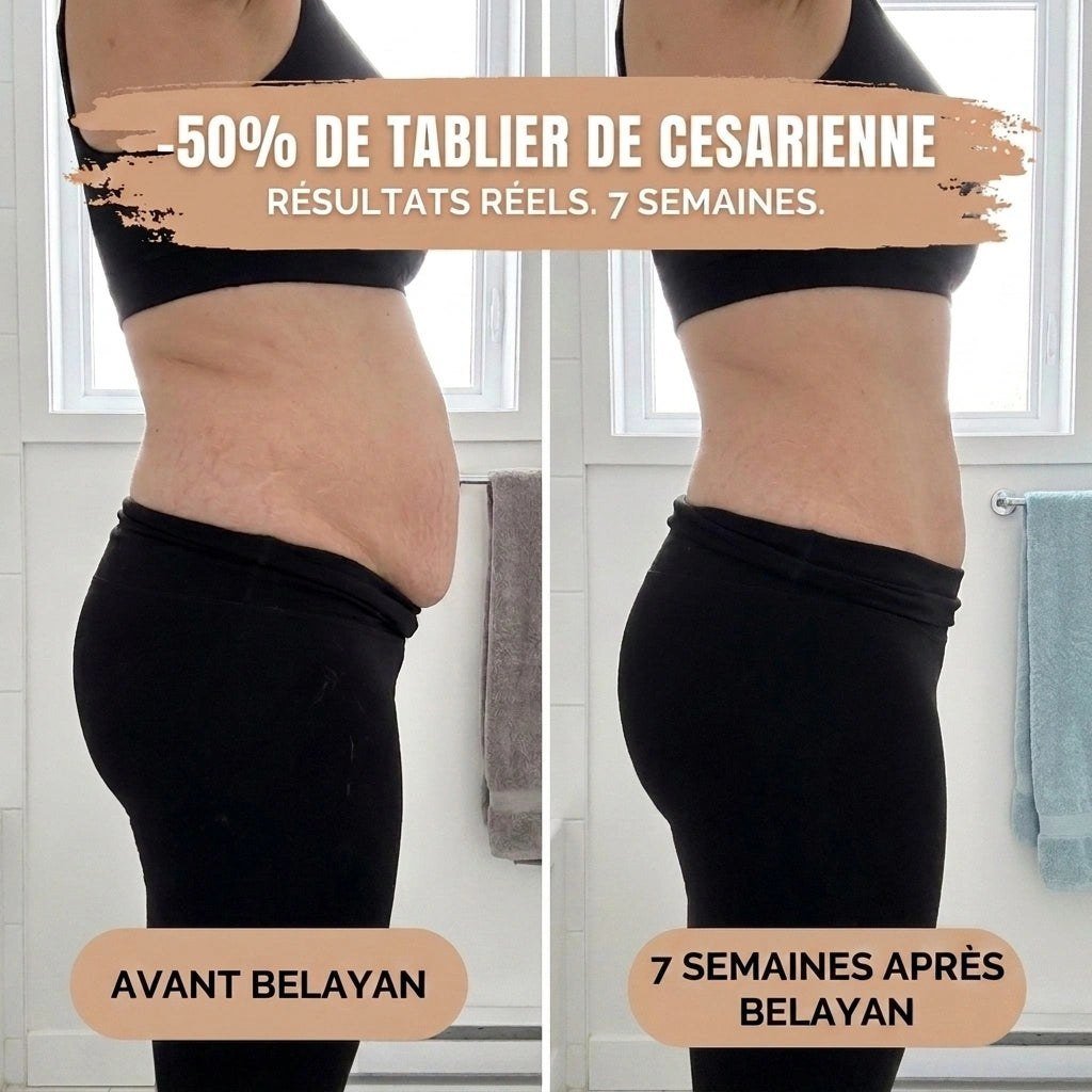 Avant / après